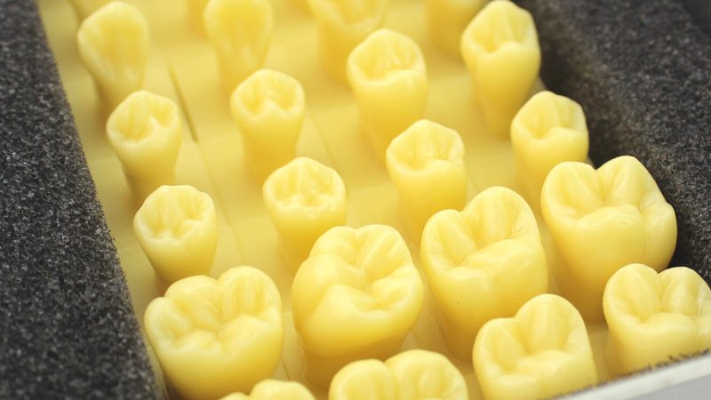 补牙后牙疼几天需要复查？了解这些关键点**